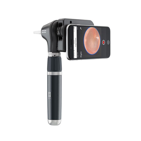 Welch Allyn® MacroView® Plus Otoscope