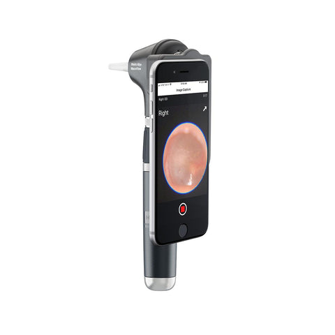 Welch Allyn® MacroView® Plus Otoscope